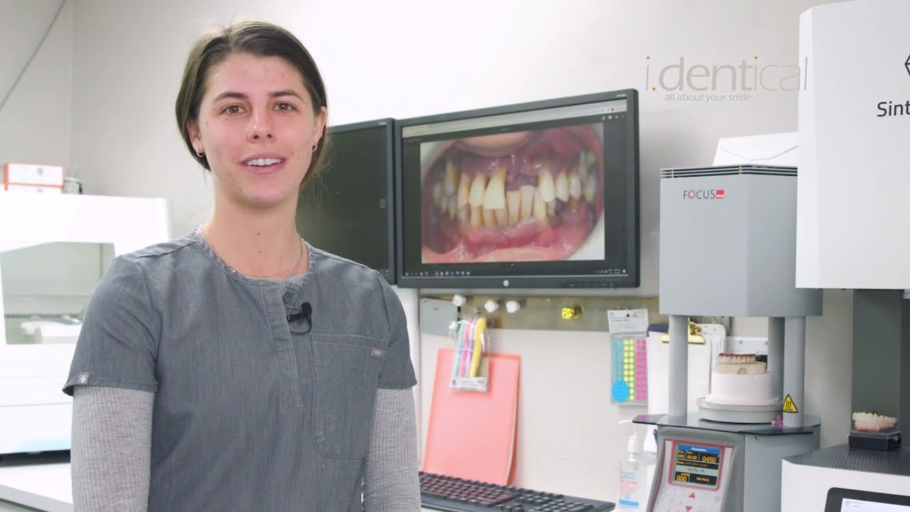 Custom Zirconia Bridge Painting - Dental Restoration - I.Dentical - Dr. Rafael E. Yanez