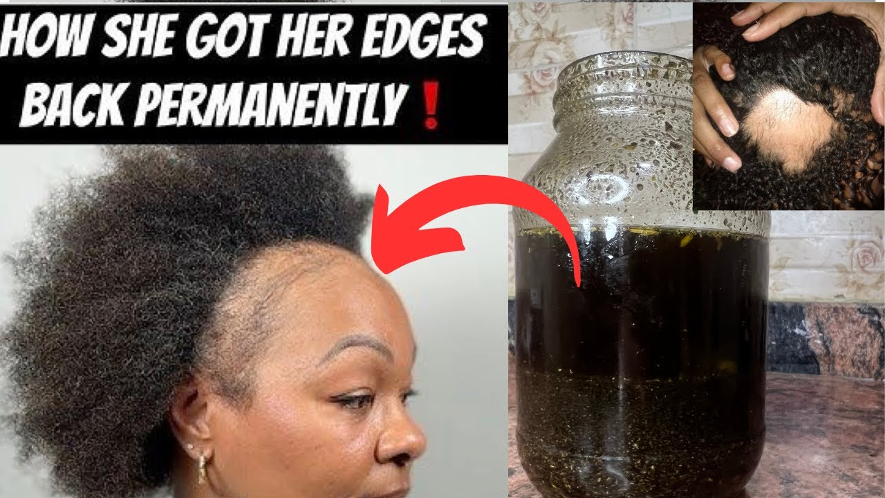 Обработайте края волос и залысины этим мощным маслом | Розыгрыш | Бренда Околоча