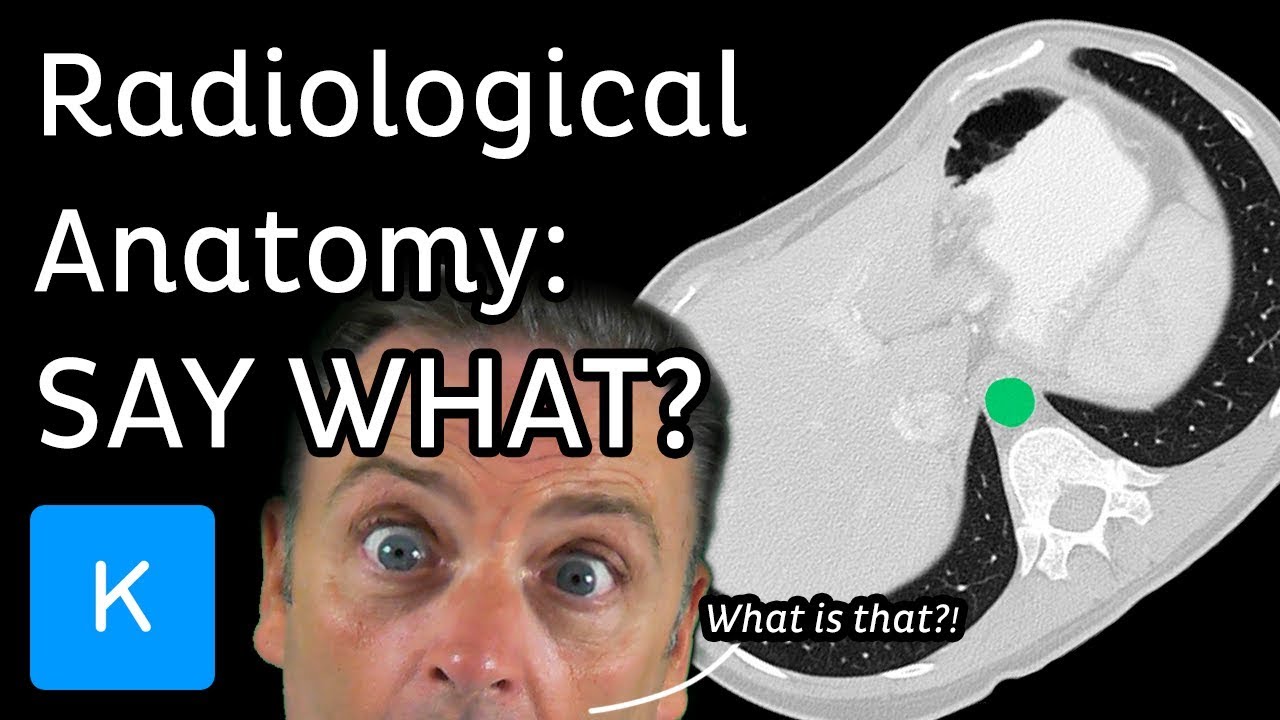 Radiological Anatomy: What is it? |&nbsp;Kenhub