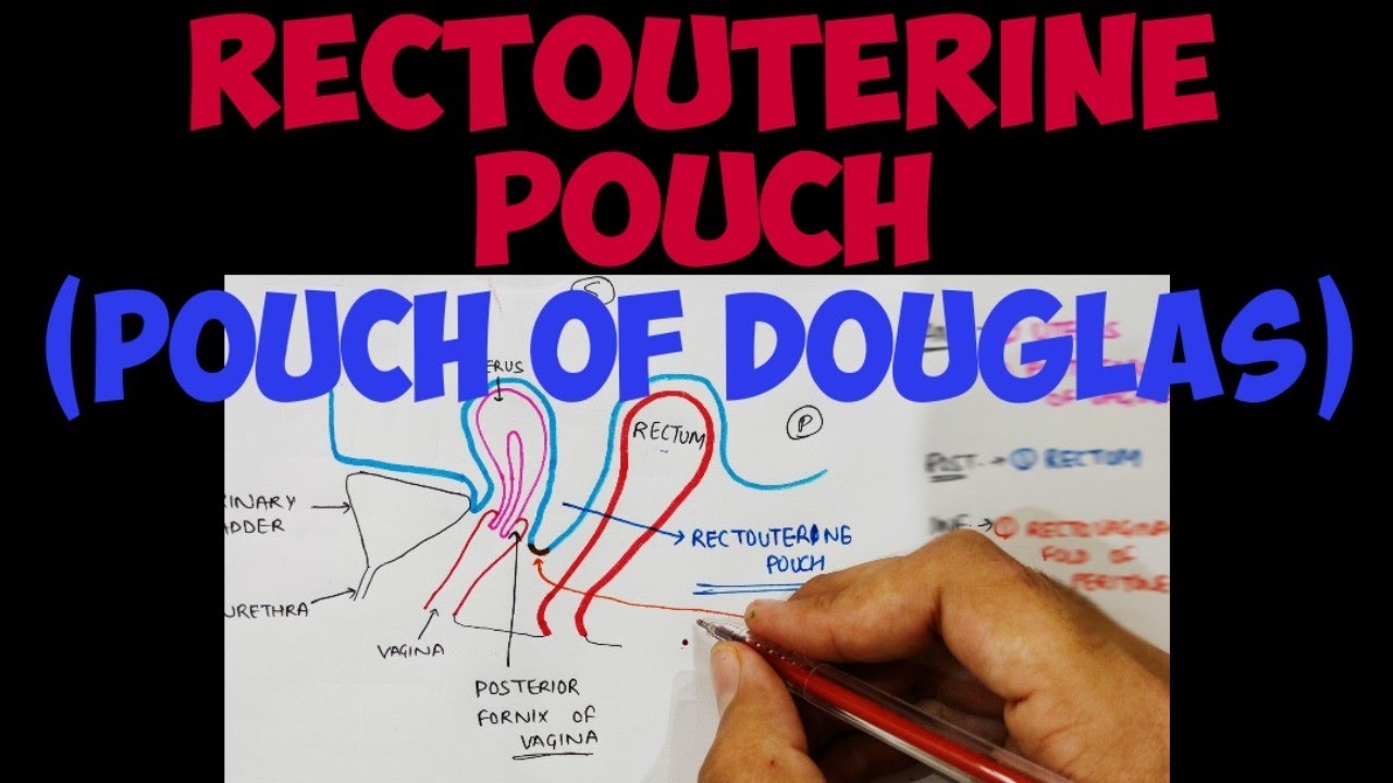 Rectouterine Pouch | Pouch of Douglas | Peritoneum