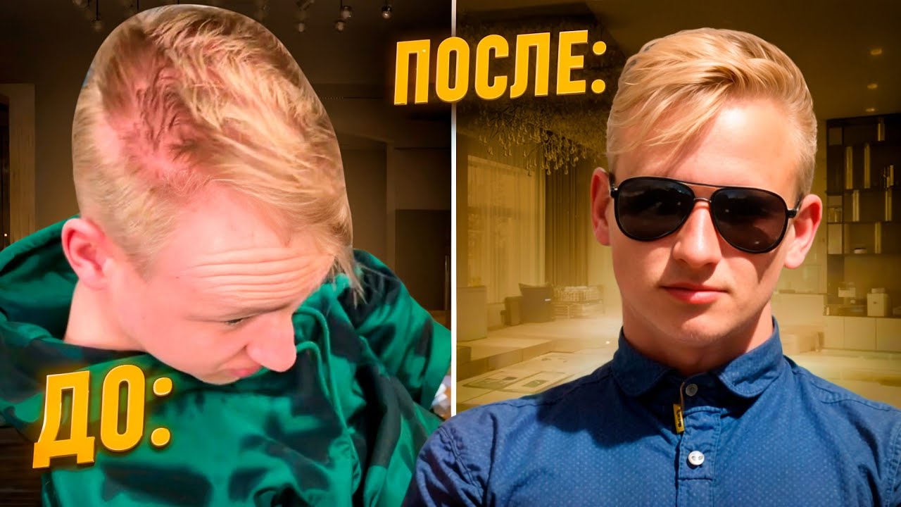 ЛУЧШИЙ ПРЕПАРАТ ПРОТИВ ОБЛЫСЕНИЯ | ФИНАСТЕРИД