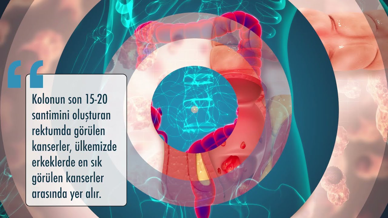 Robotik cerrahi ile rektum kanseri tedavisinin avantajları nelerdir? - Doç. Dr. Cevher Akarsu