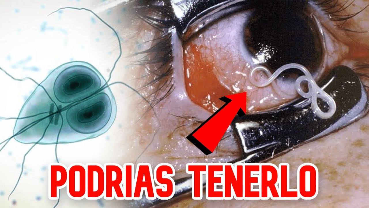 Los 10 par&aacute;sitos mas LETALES que existen