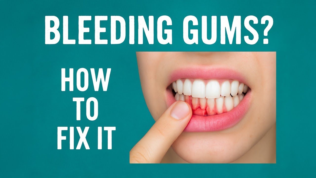 Bleeding Gums? Here's What It Means & How to Fix It