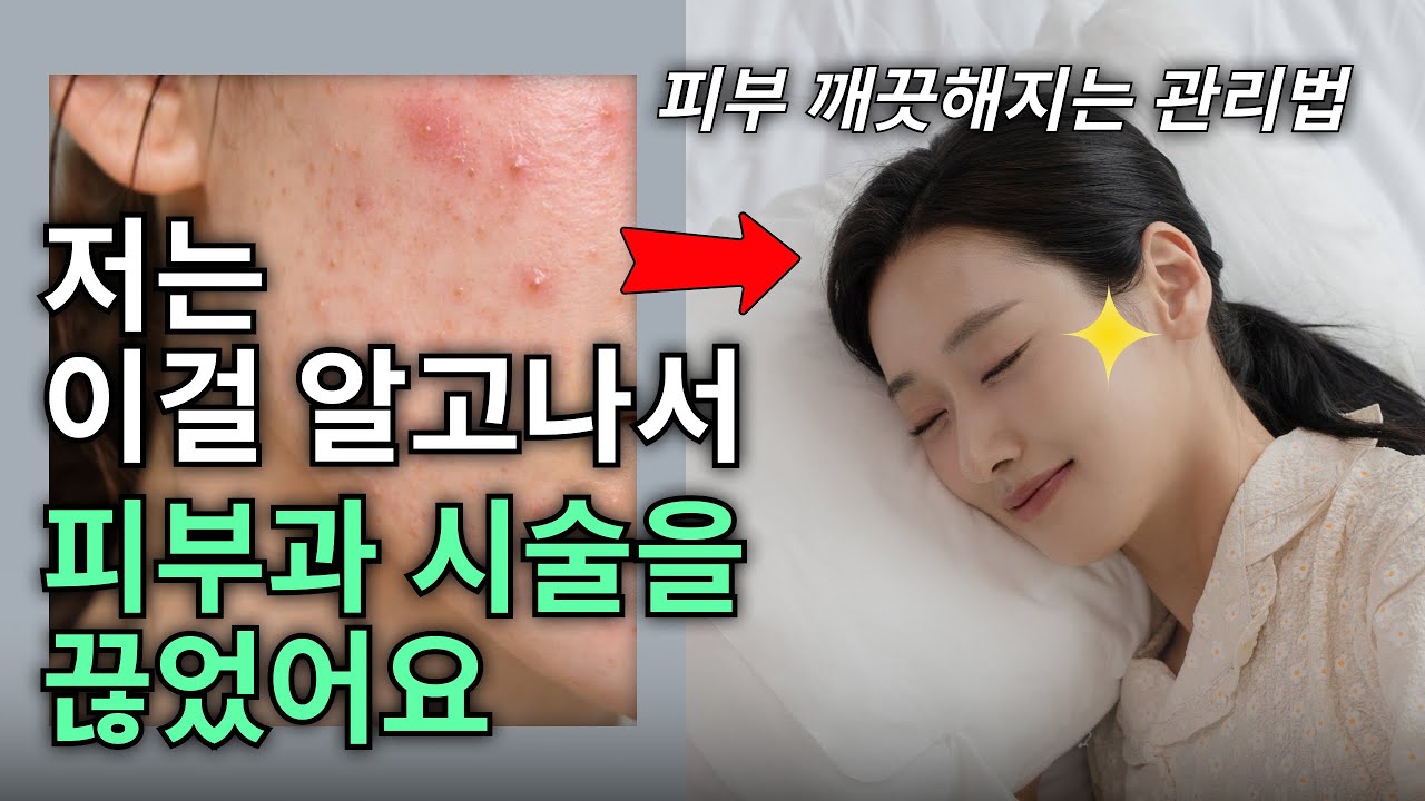 피부 좋아지는 필수 관리법! 이거 모르면 피부과 시술해도 소용 없어요. 피부 위생 습관 챙기는 일상 관리법!
