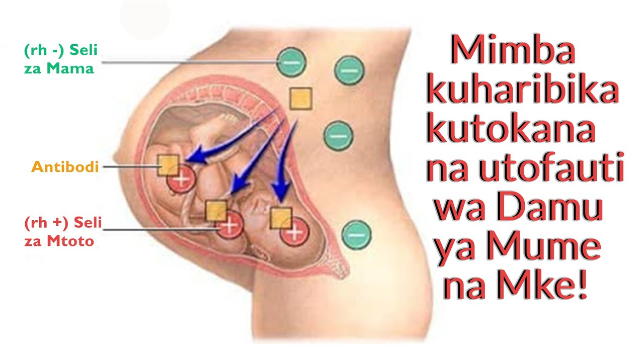 Mimba kuharibika kutokana na utofauti wa Damu ya Baba na Mama | Visababishi na Jinsi ya kuepuka!??