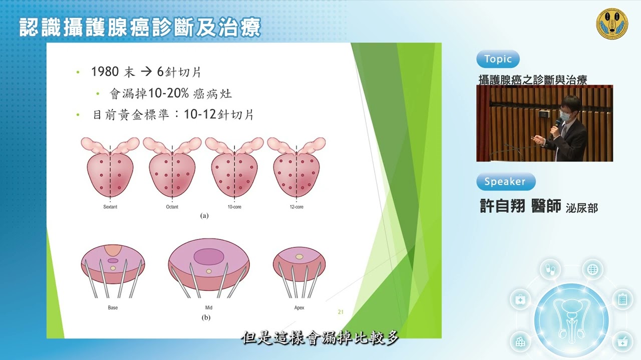 2攝護腺癌診斷及治療 許自翔