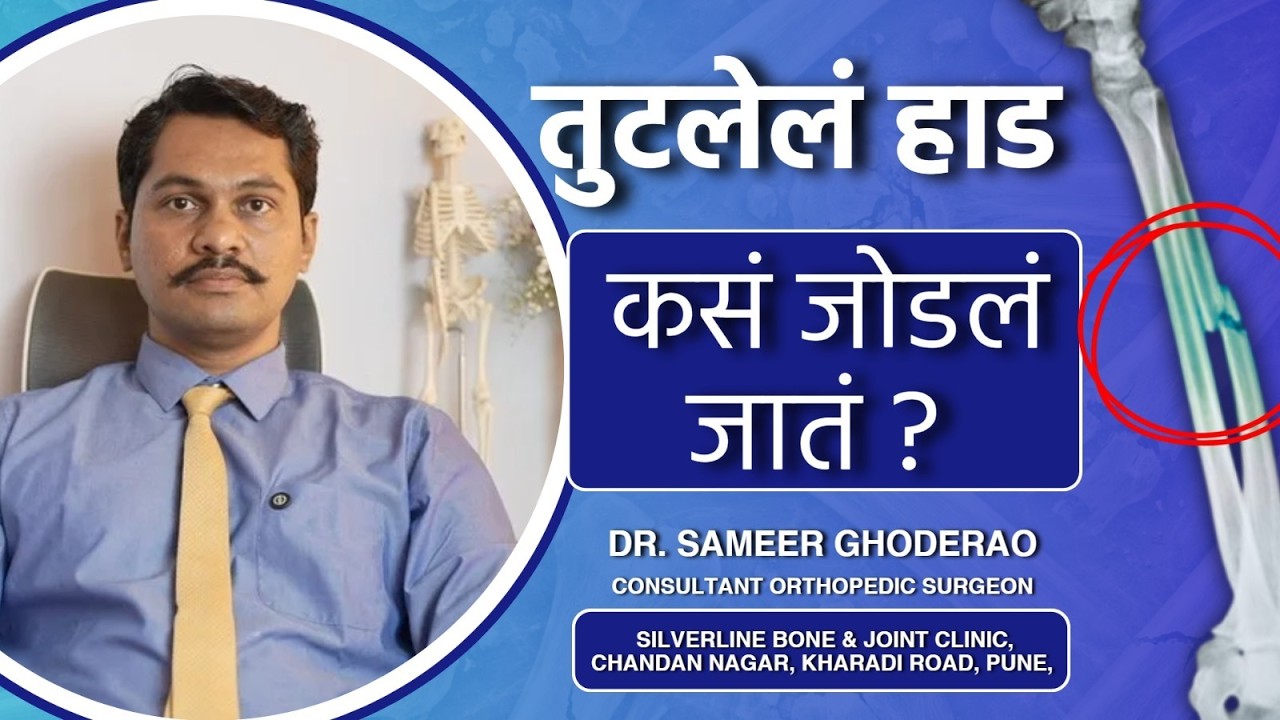 How Long Does It Really Take for a Broken Bone to Heal? | Dr Sameer Ghoderao #bonehealing