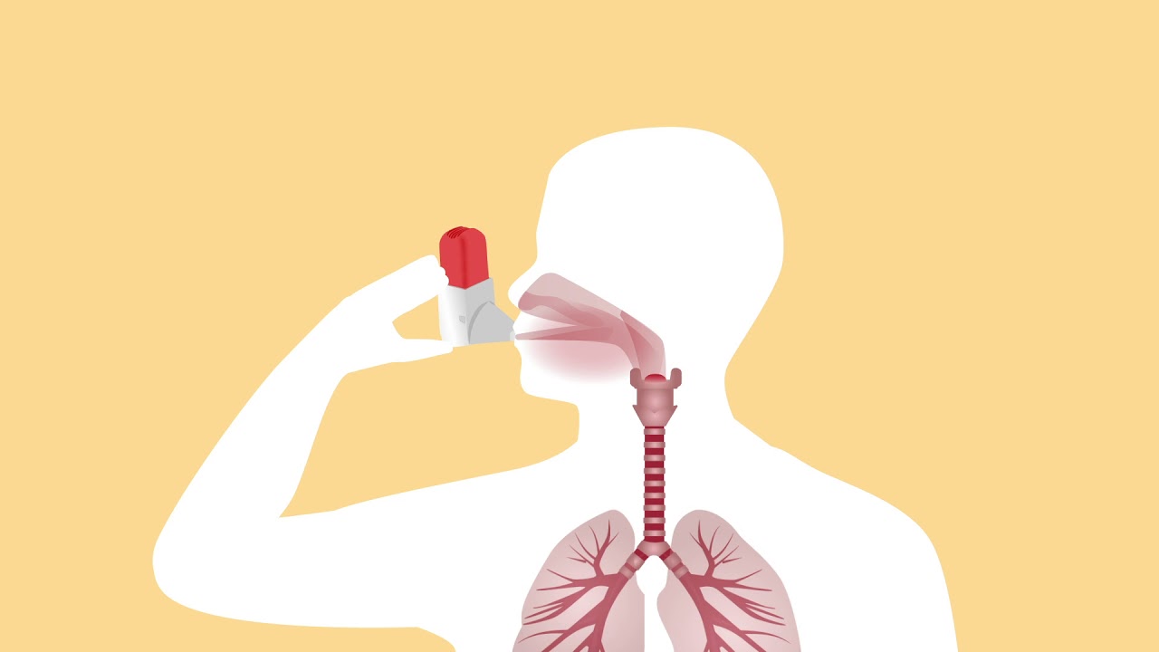 Understanding dry powder inhalers