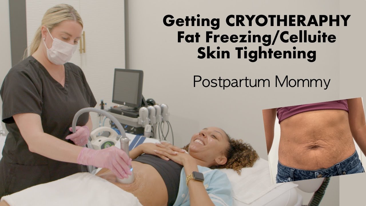 Getting CRYOTHERAPY on my Postpartum Tummy! Mary Scott Skincare | BiancaReneeToday
