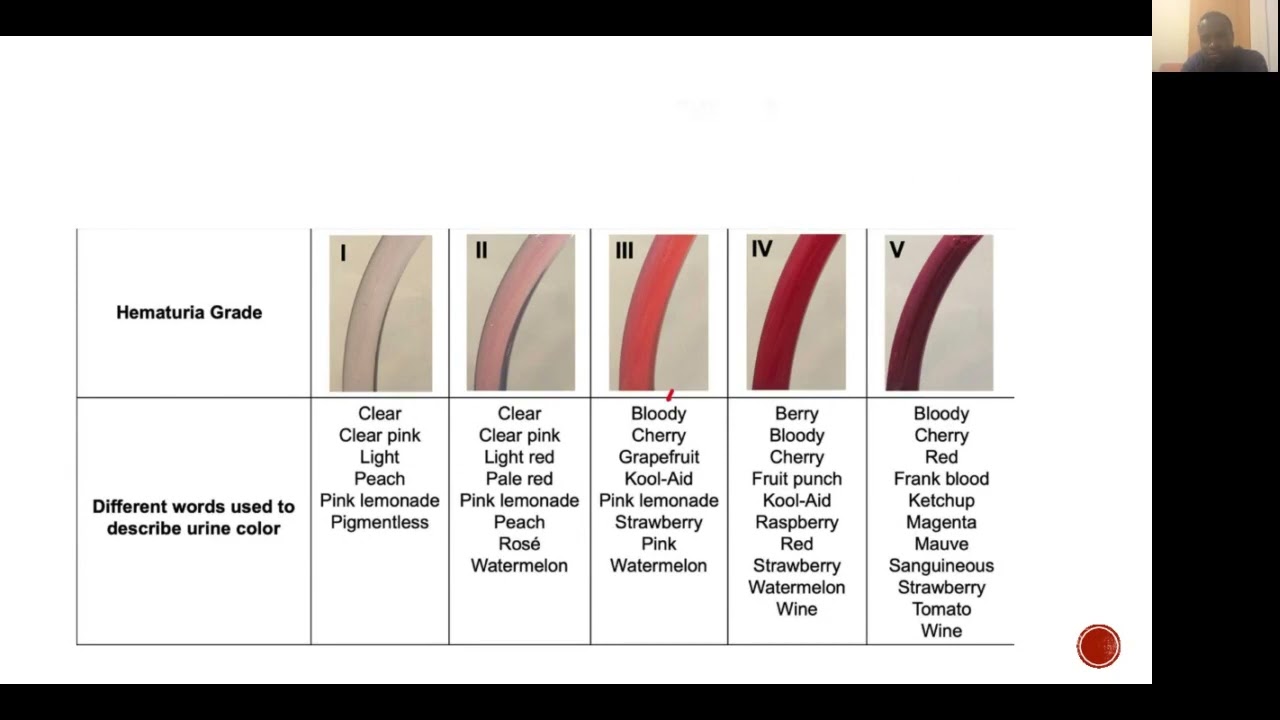 Haematuria: Principles and Management