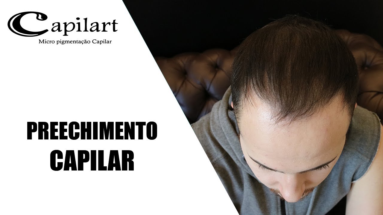Micropigmentação capilar 3D - YouTube 2023