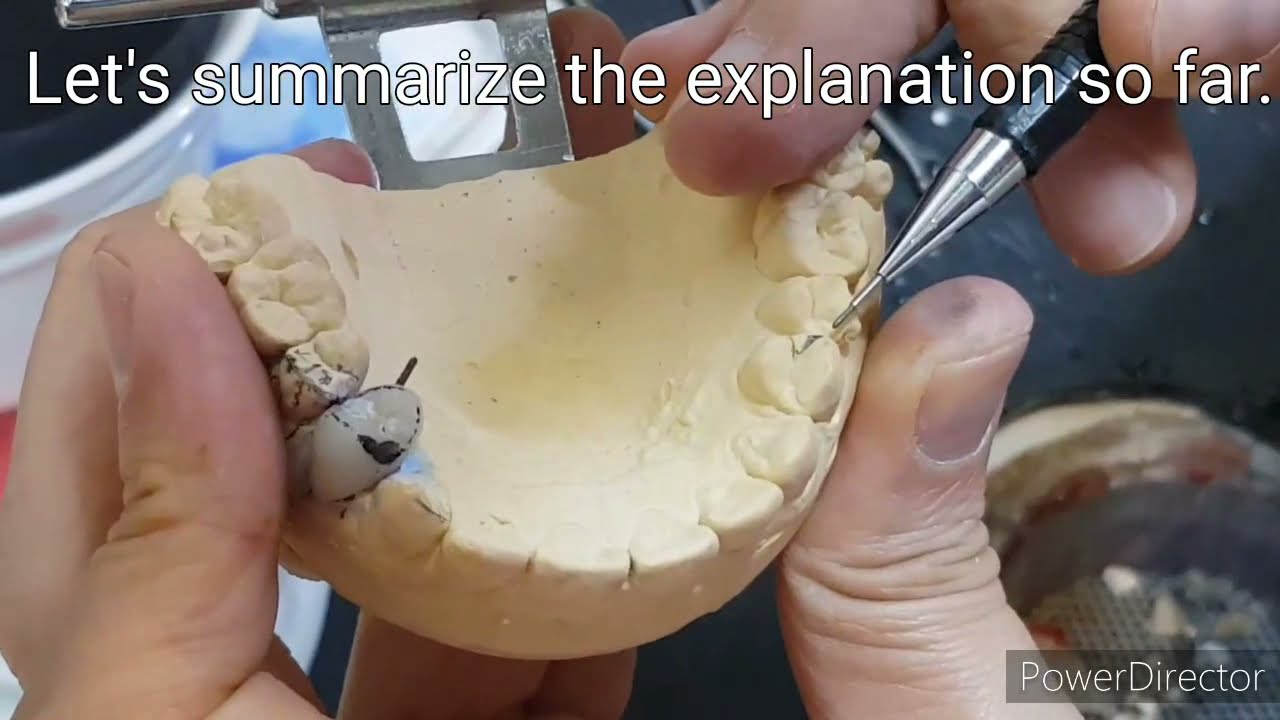 #소구치 #Premolar #상악 #Upper #컨터링 #Contouring Part 3.