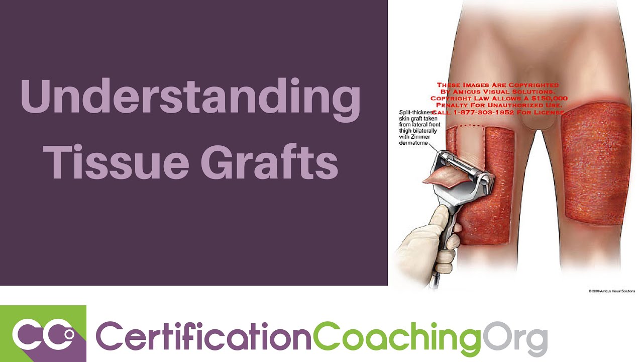 Understanding Tissue Grafts