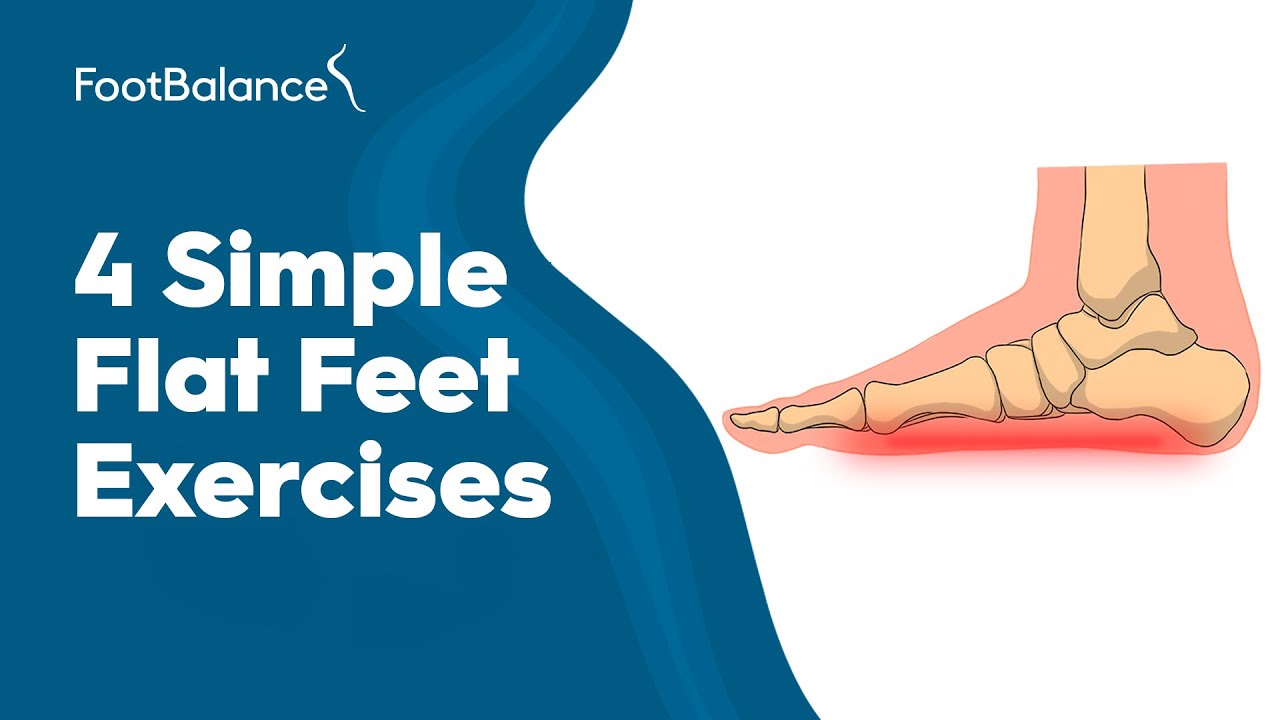 Flat Feet | Pes Planus
