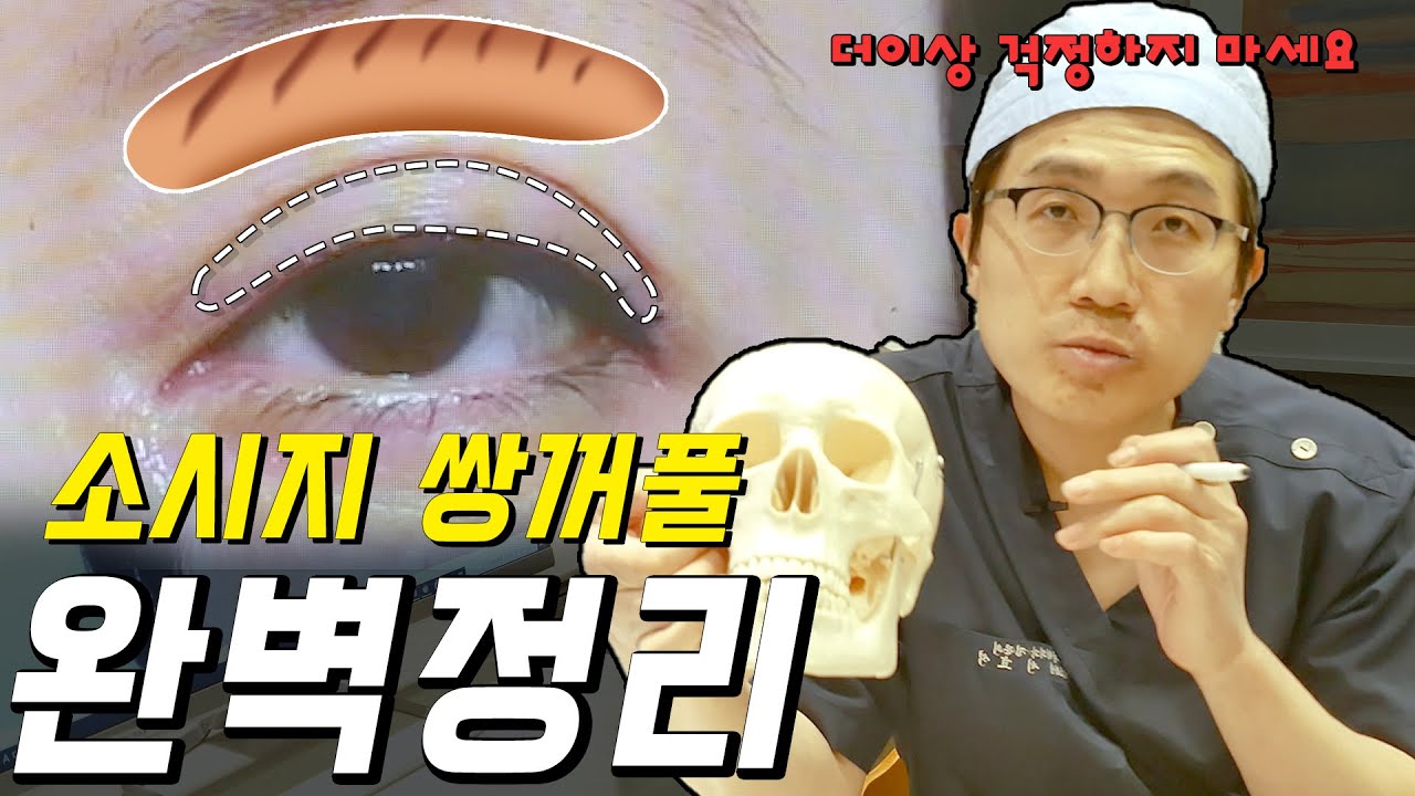 소시지 쌍꺼풀 여러군데 다녀보셔야 들을 수 있는 자세한 내용