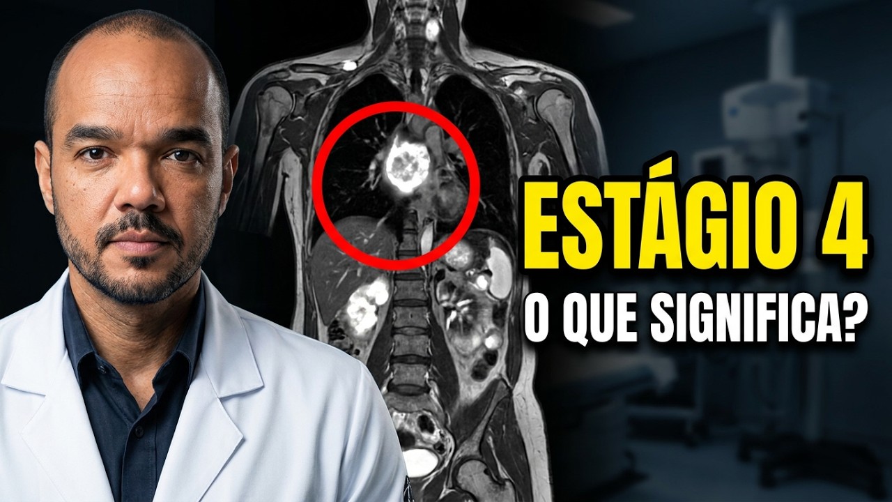 Entenda o que é um câncer em estágio 4: METÁSTASE SEM CURA?  QUAL O TEMPO DE VIDA?