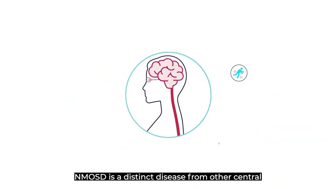What is Neuromyelitis Optica Spectrum Disorder (NMOSD)?