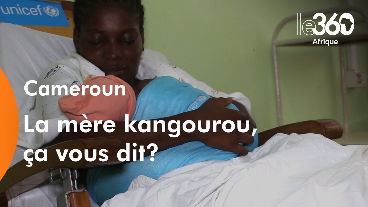 Cameroun: mère kangourou, une méthode recommandée par l'OMS