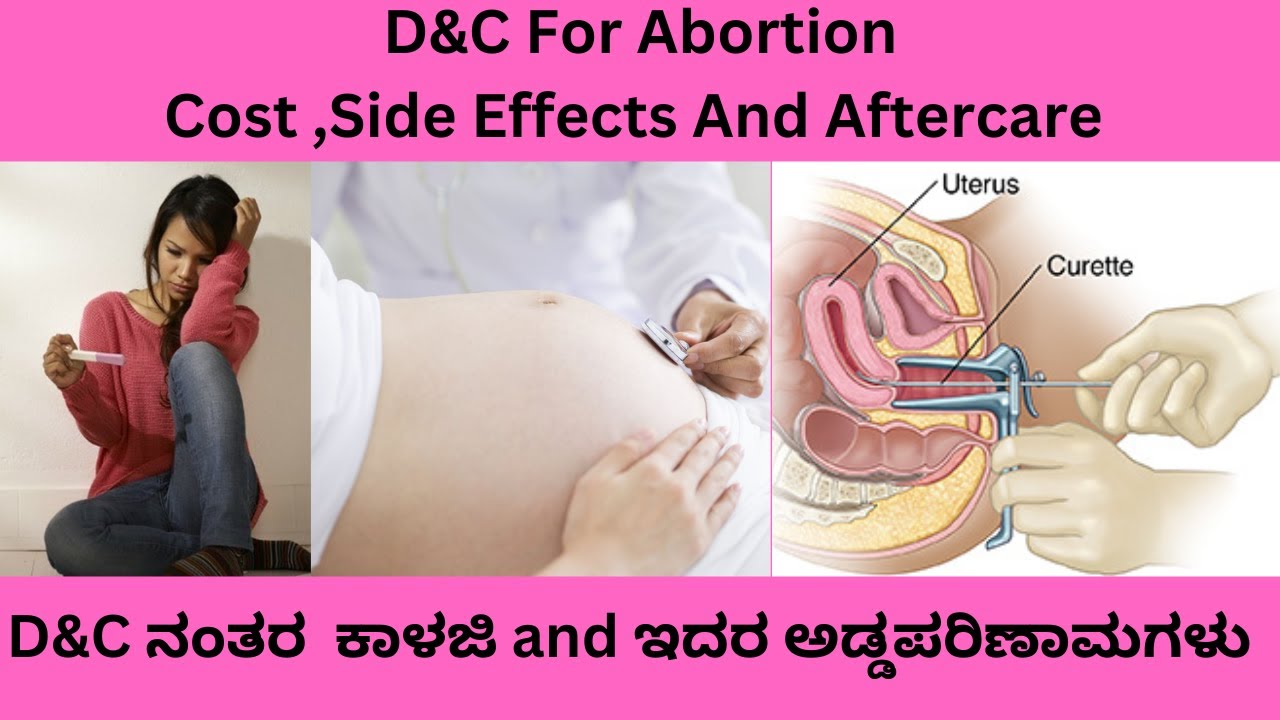 D AND C (DILATATION AND CURRETAGE) IN KANNADA.INDICATIONS,COST,PROCEDURE ,AFTERCARE,SIDE EFFECTS