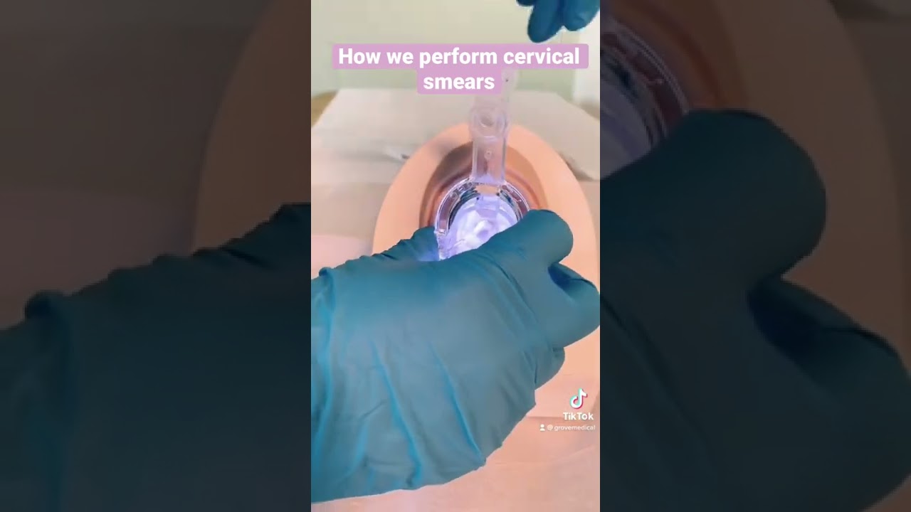 How we perform cervical smears