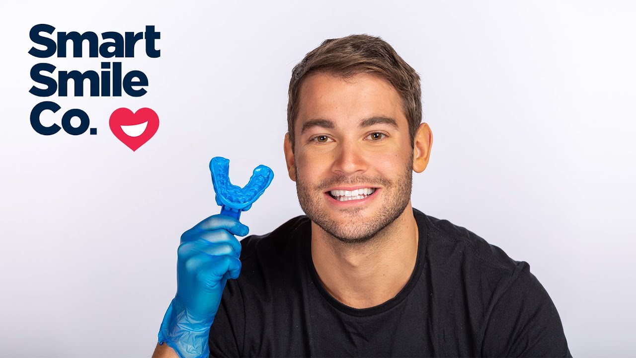 Impression and Photo Guide: Completing your Impression Kit