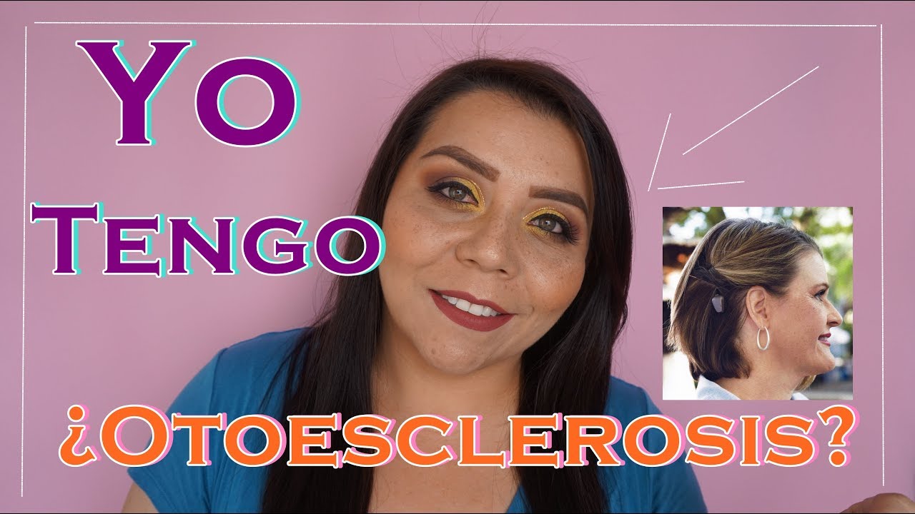 Otoesclerosis mi experiencia | Enfermedades de OIDO