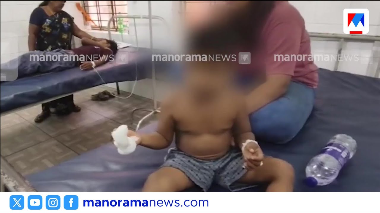 വരാന്തയിൽ കളിച്ചുകൊണ്ടിരുന്ന 3 വയസ്സുകാരന്റെ വിരൽ തെരുവുനായ കടിച്ചെടുത്തു | Haripad Stray Dog attack