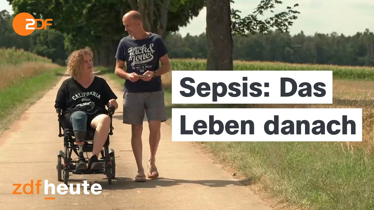 Sepsis: So gefährlich ist eine Blutvergiftung