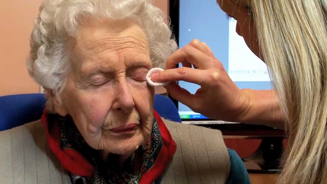 Blepharitis