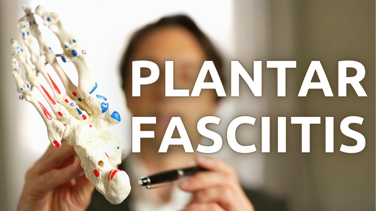 PLANTAR FASCIITIS - About this heel pain, the causes, how to examine and diagnose.