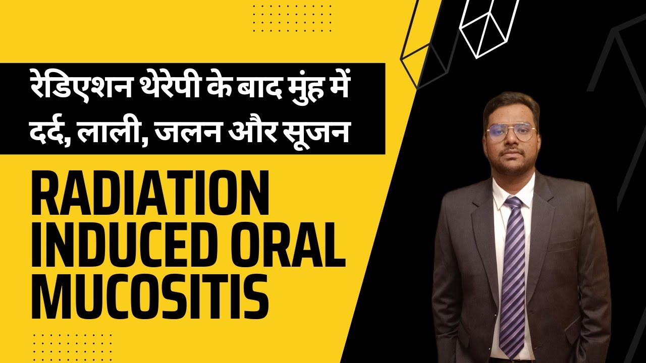 Dr Rudra Mohan | रेडिएशन थेरेपी के बाद मुंह में दर्द जलन और सूजन |Radiation Induced Oral Mucositis