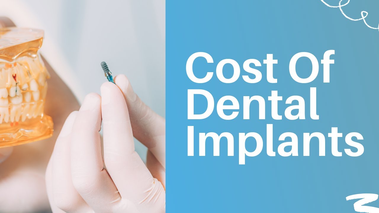 Cost Of Dental Implants