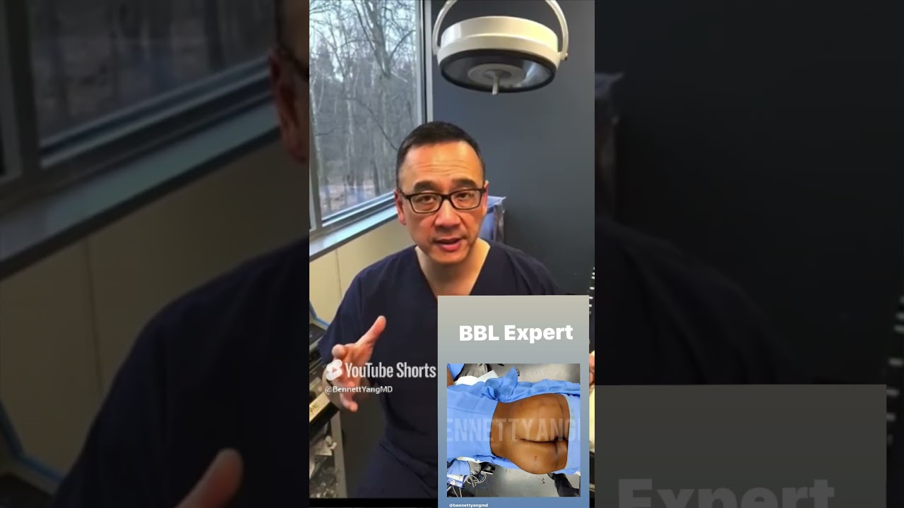 BBL (Brazilian Butt Lift) Surgery Explained With Expert Body Reshaping Surgeon, Bennett C. Yang, MD