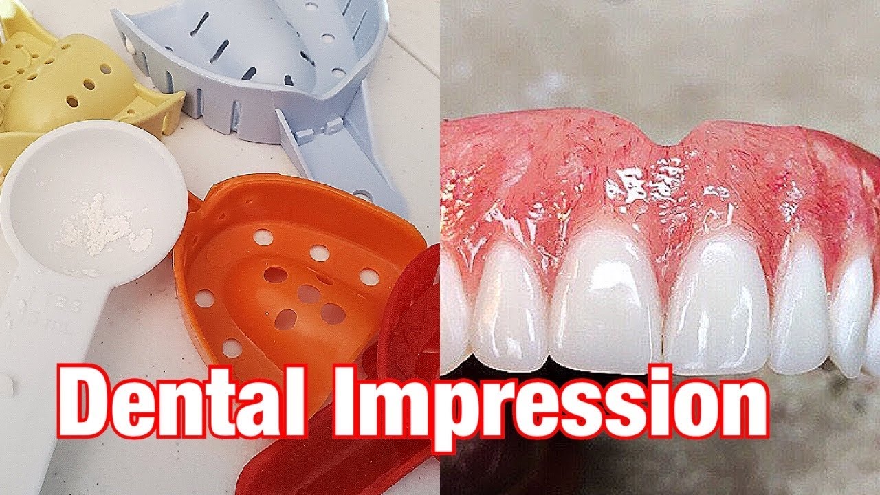Home dental impressions Tutorials.