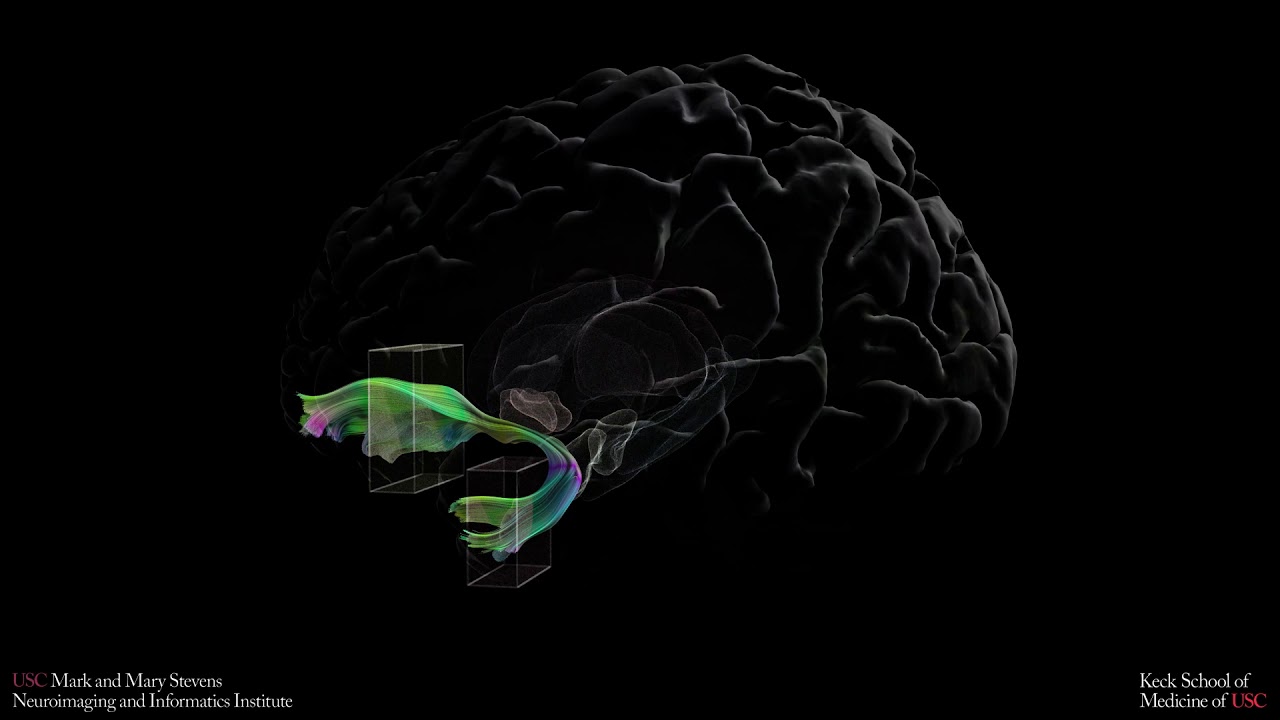 Human Connectome Diffusion tractography