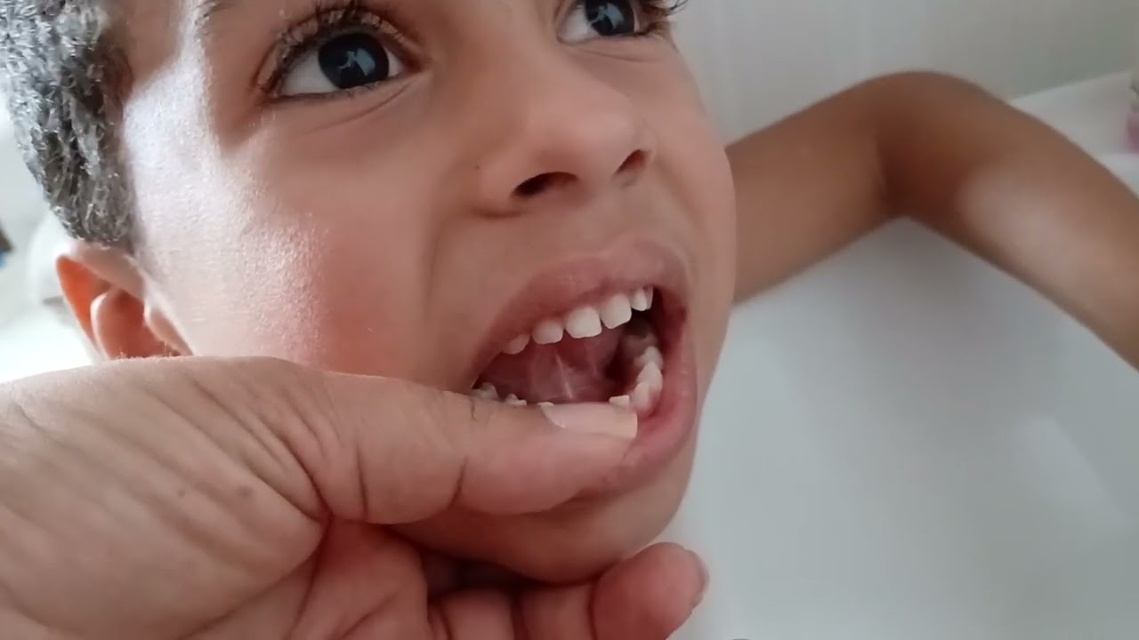 Tirei o primeiro dentinho de leite de meu filho | Pietro Vital