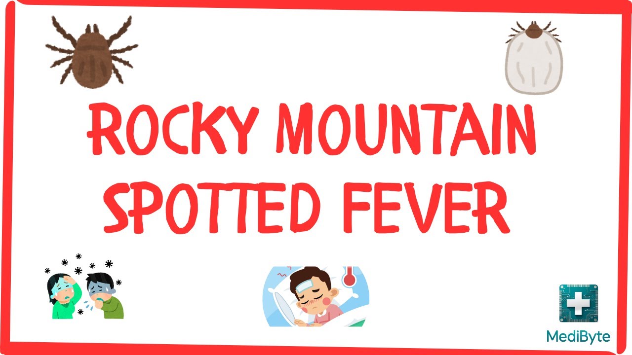 What is Rocky Mountain Spotted Fever (RMSF)? 🕷️