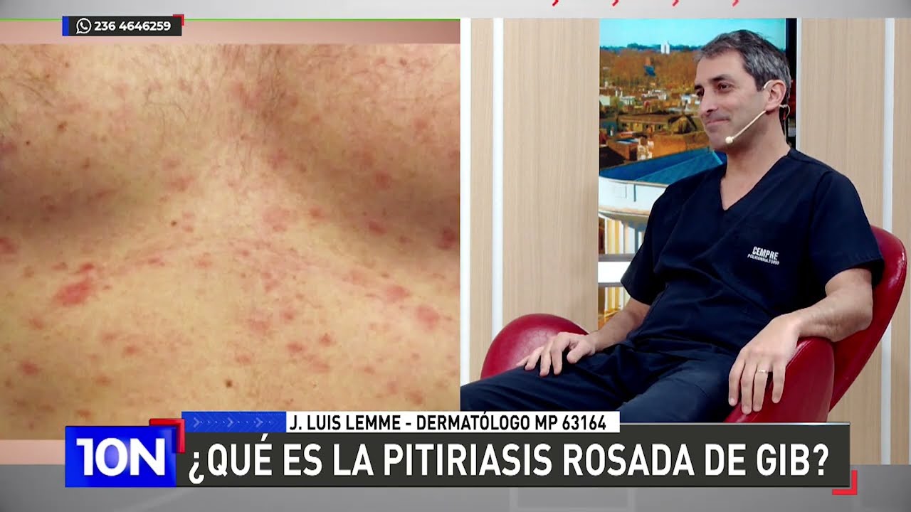 ¿Qué es la pitiriasis rosada de gib?