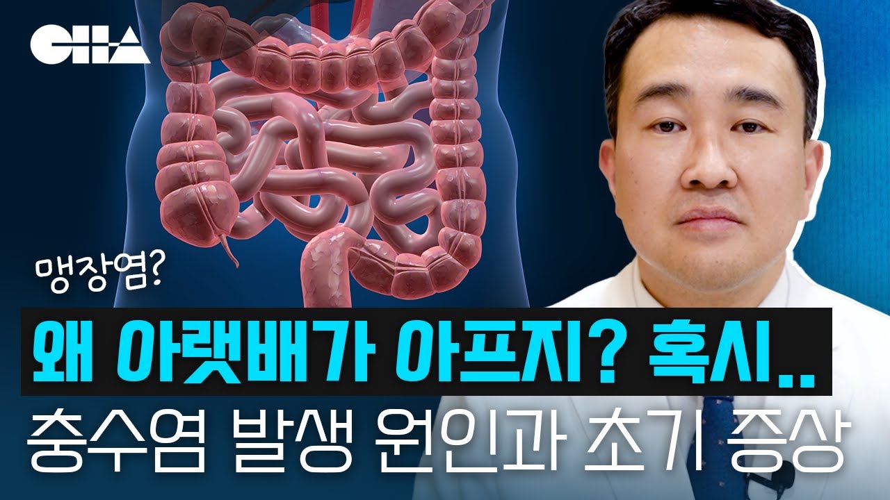 충수염? 맹장염? 자가진단할 수 있는 초기 증상과 발병 원인은? +급성&만성 비교