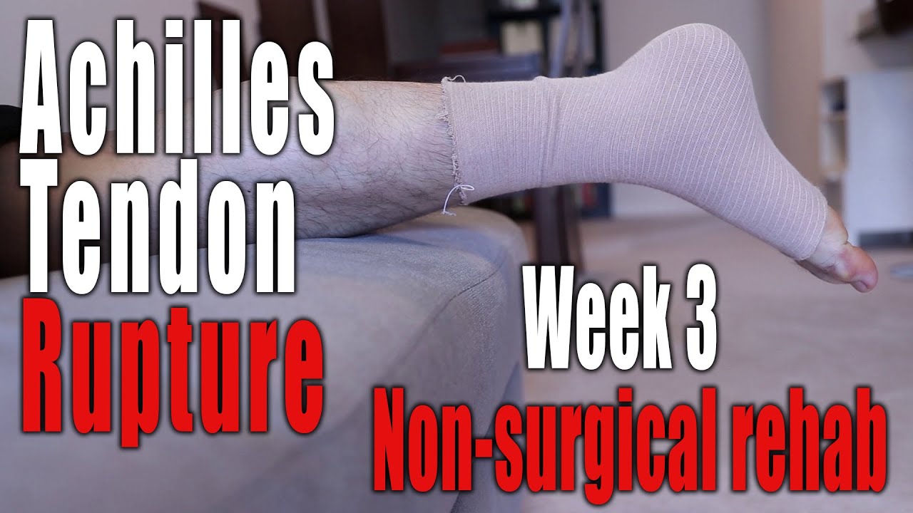 Achilles Tendon Rupture, Non-Surgical Recovery | Week 3: Day 16, Exercises Begin