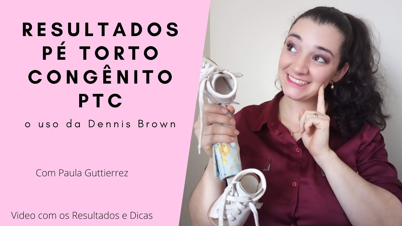 Dicas e Resultados Órtese Dennis Brown - Pé Torto Congênito PTC