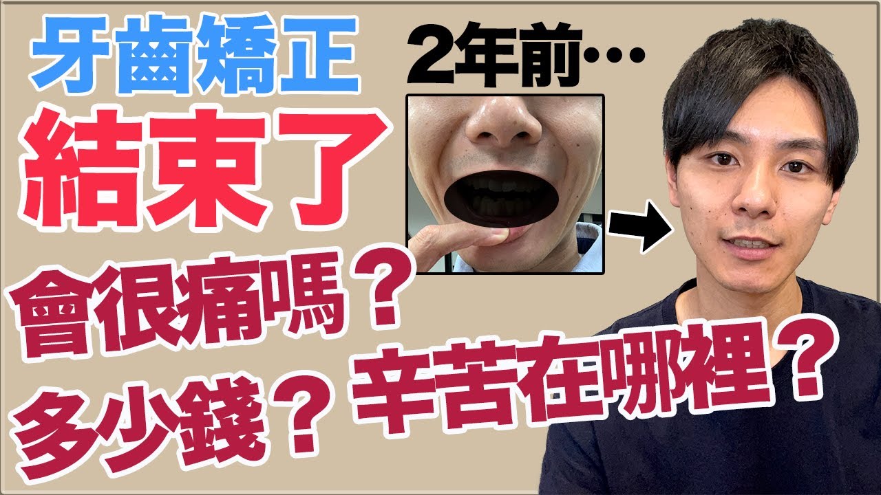 【報告】牙齒矯正結束了！來跟以前比較吧！費用？期間？矯正辛苦在哪裡？大介 -我的日文-