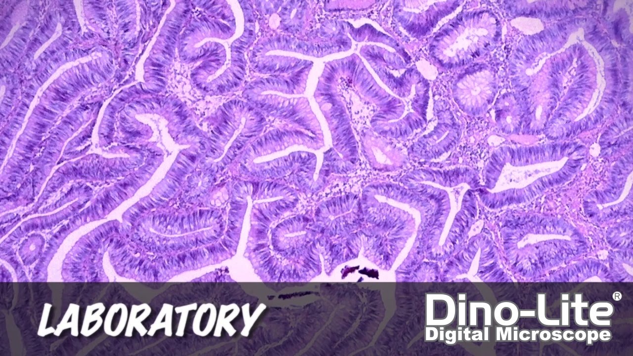 Dino-Lite Applications: Laboratory