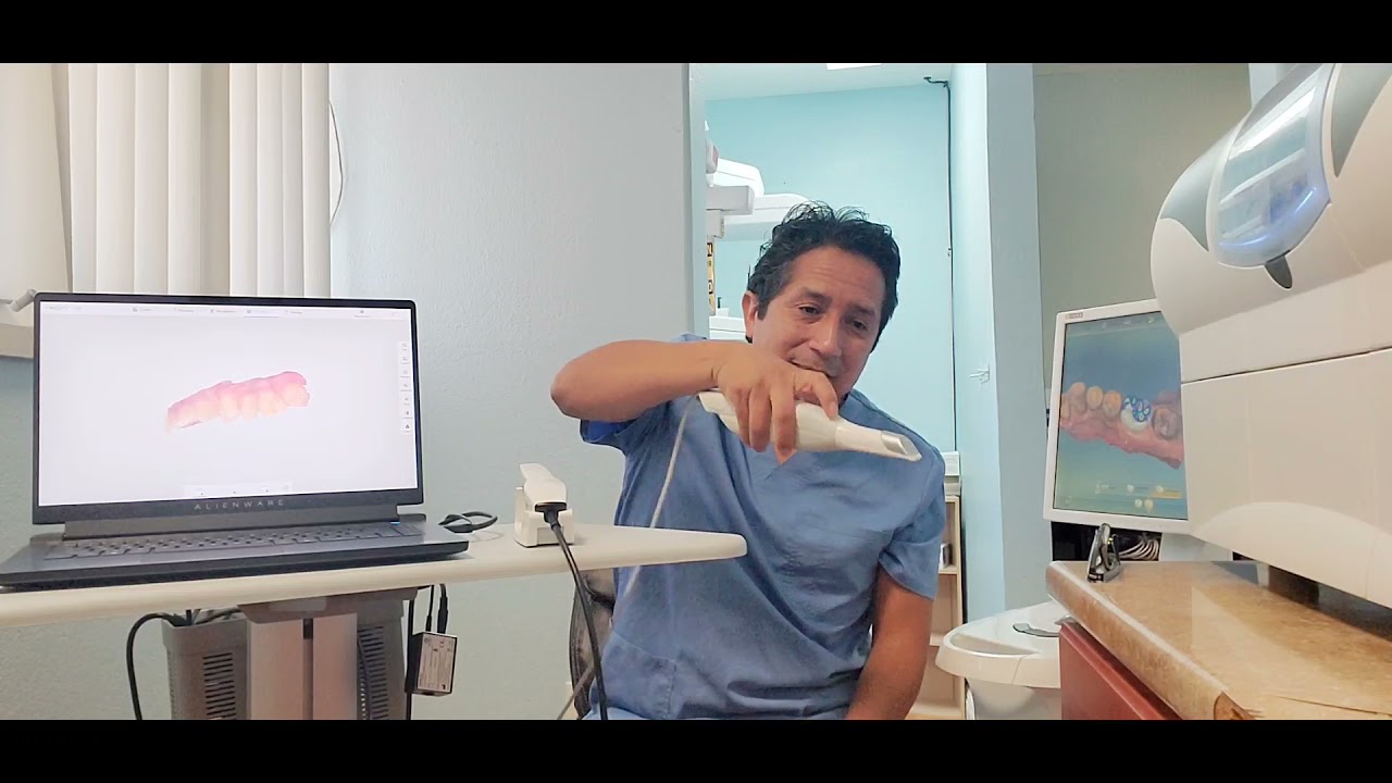 ESCANEADOR DENTAL PANDA P2 PERU