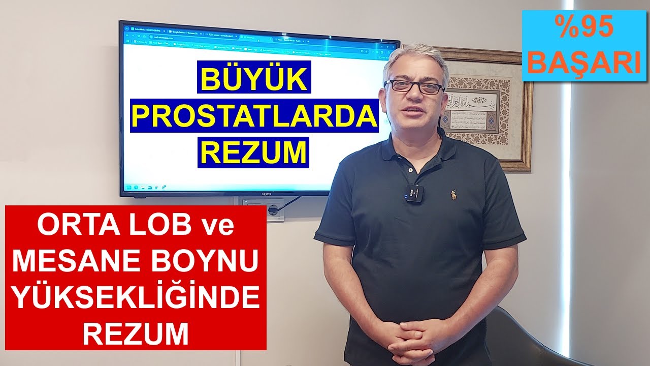 Rezum Tedavisi Orta Lobu ve Mesane Boynu Yüksek BÜYÜK PROSTATLARA %95 Başarı ile Uygulanabiliyor!