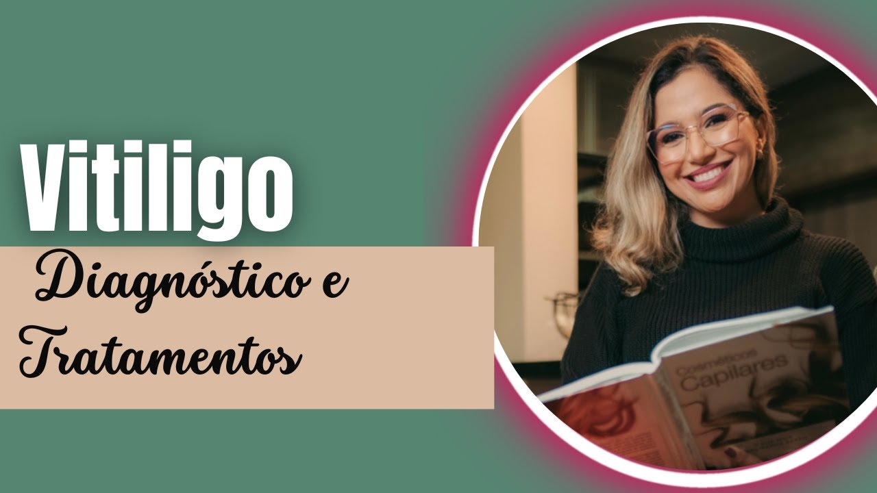Como conduzir casos de Vitiligo