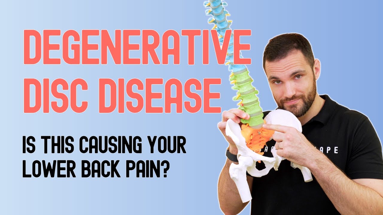 Why Is Degenerative Disc Disease Causing Low Back Pain?