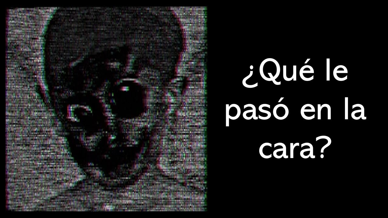 Vi a este niño mientras caminaba por el parque | Assessment Examination