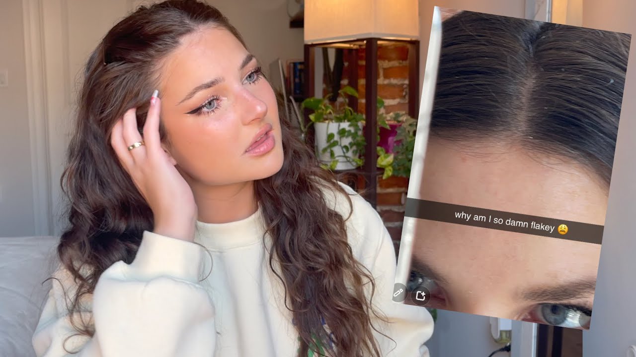 my healthy scalp routine // how I fixed my dry flakey scalp (for wavy hair)